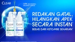 CLEAR’s cutting-edge ScalpPro Tech™ technology
